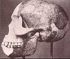 Piltdown Man